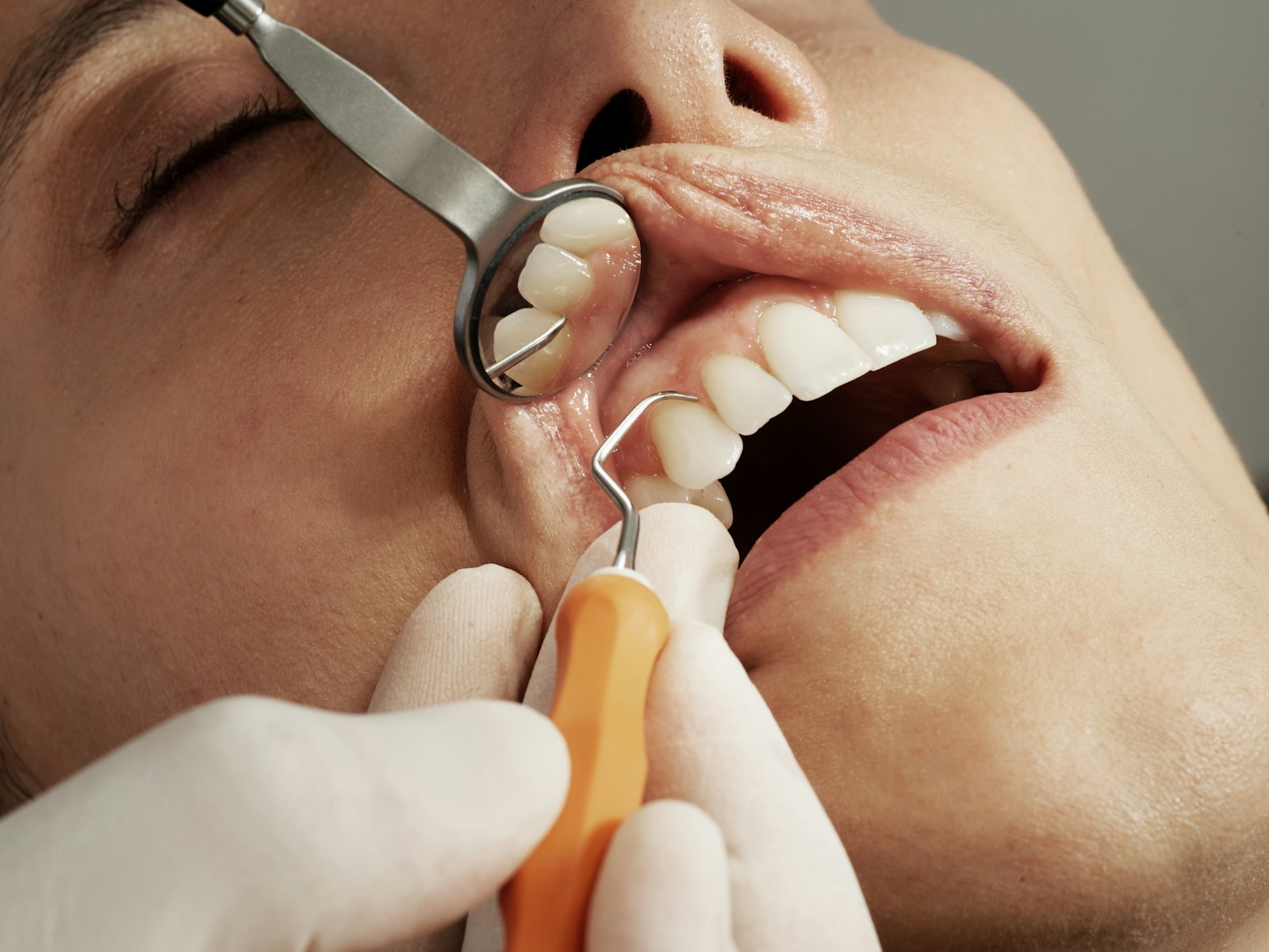 Dental professional performing a careful oral examination